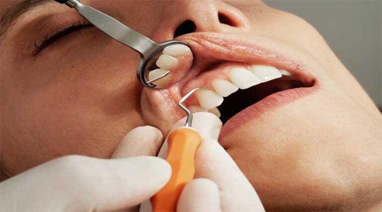 why-do-you-need-to-consider-dental-implants
