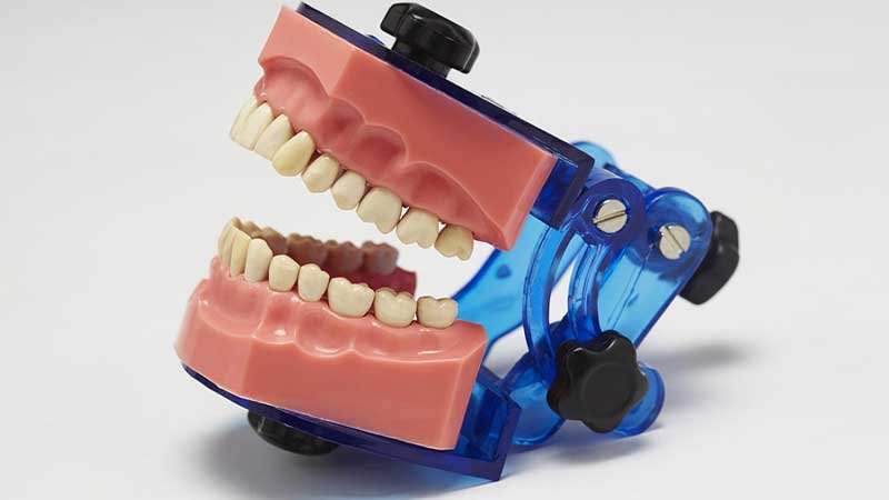 Pros and Cons of Implant-Supported Dentures