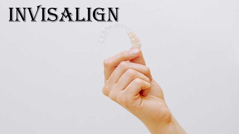 Invisalign