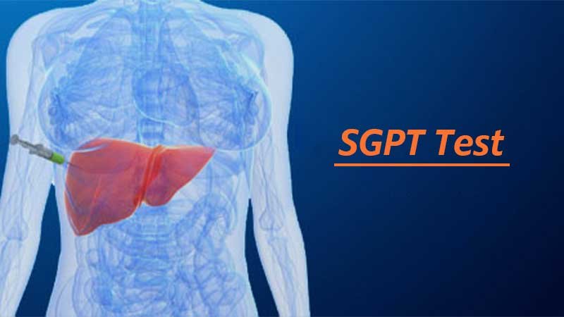 All About SGPT Test